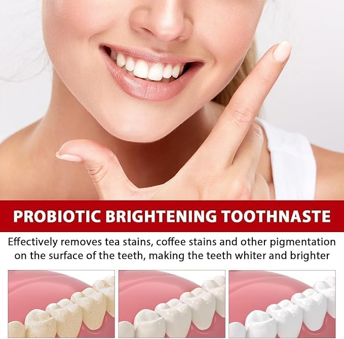 SP-4 Probiotic Whitening Toothpaste – Bright Smile, Strong Enamel!