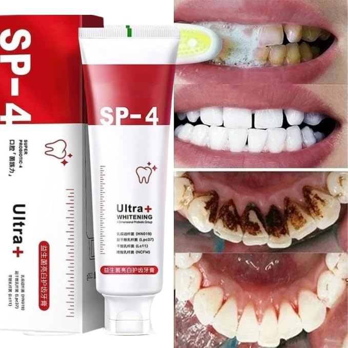 SP-4 Probiotic Whitening Toothpaste – Bright Smile, Strong Enamel!