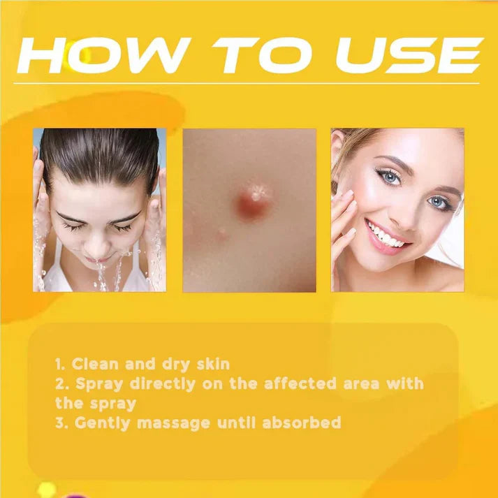 Bee Venom Skin Tag & Wart Remover Spray - Rs.1499/-